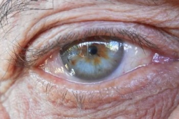 AMD-Research looks at new possibilities for eye care